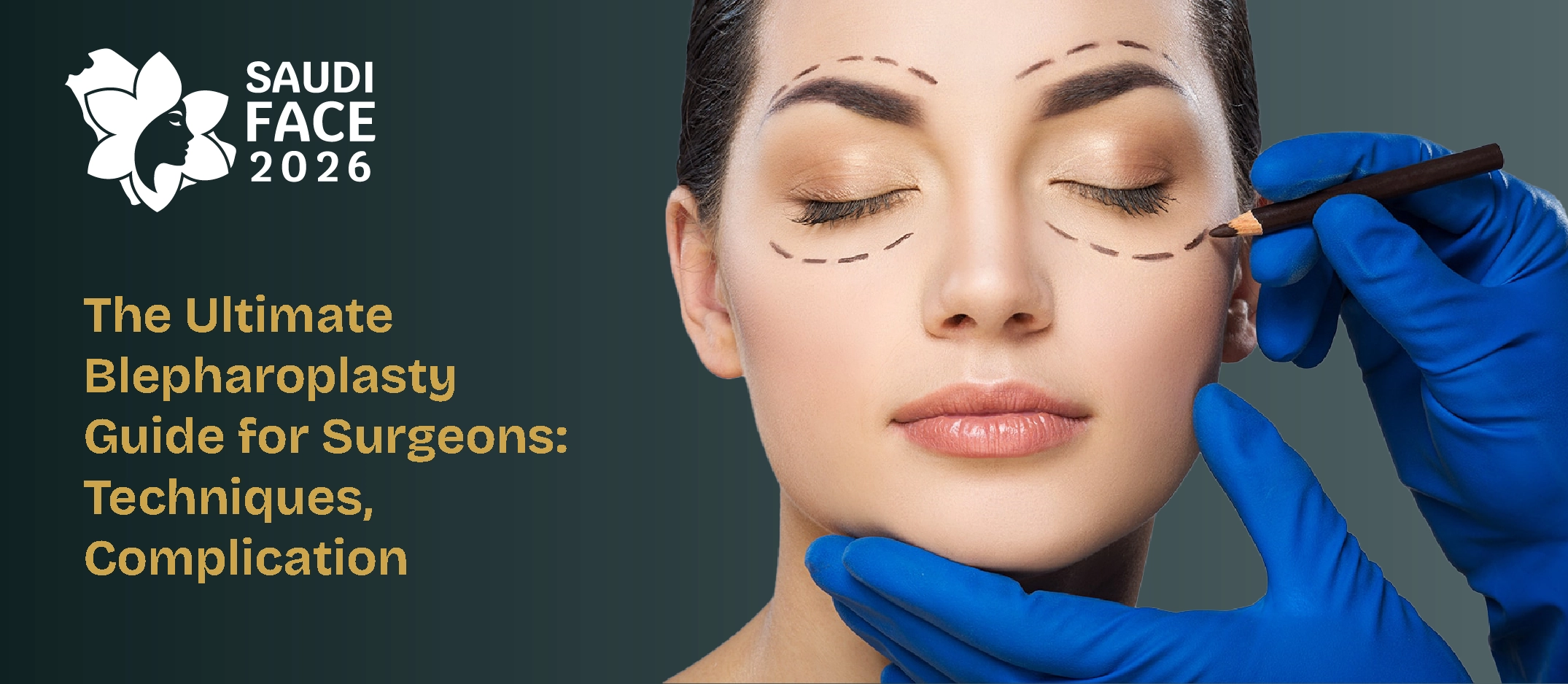 The Ultimate Blepharoplasty Guide for Surgeons: Techniques, Complications