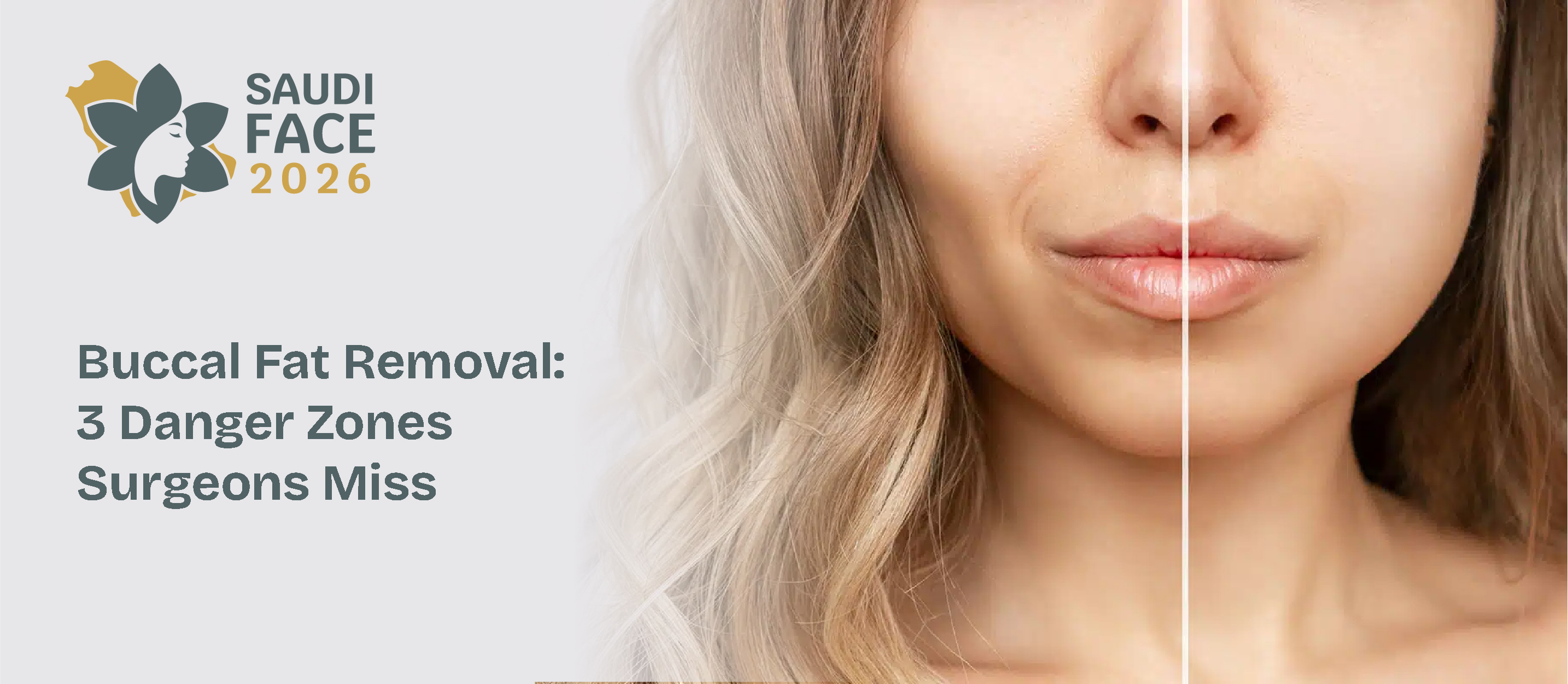 Buccal Fat Removal: 3 Danger Zones Surgeons Miss