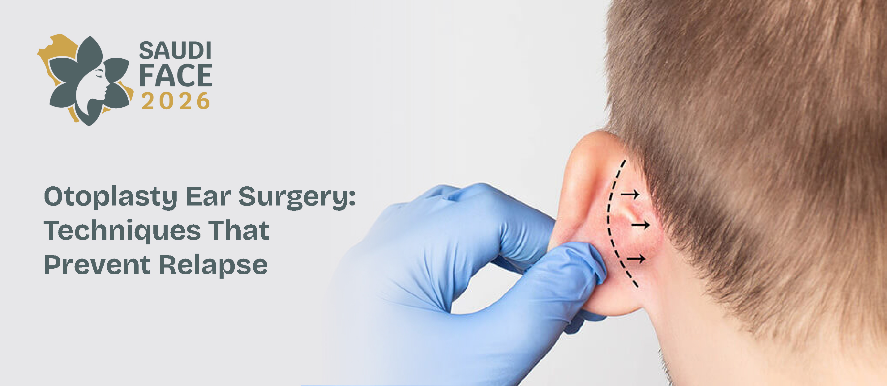 Otoplasty Ear Surgery: Techniques That Prevent Relapse